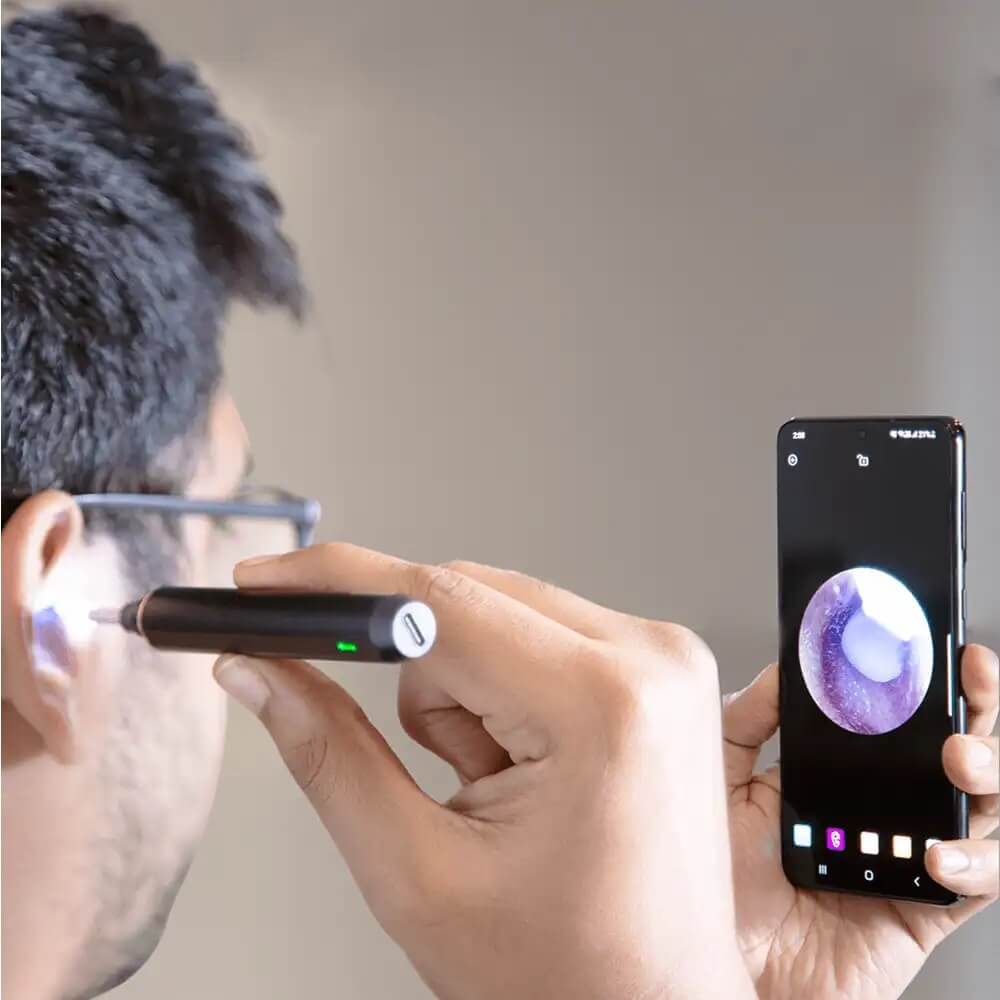 Fawes Otoscope- Intelligent Ear Wax Cleaner